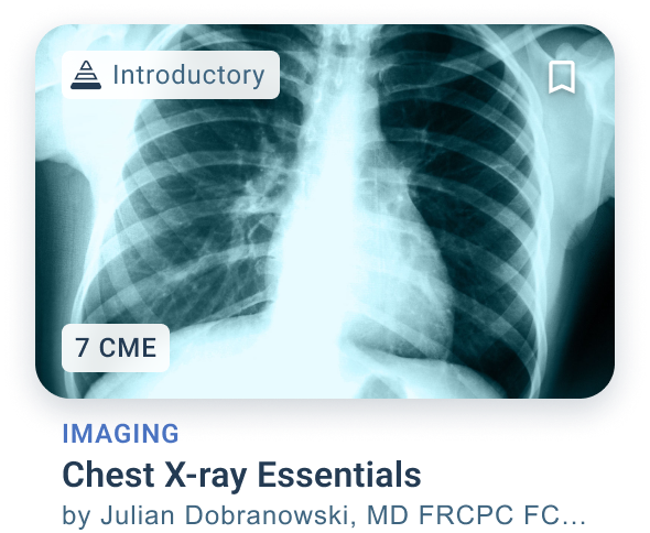 Chest X-ray Essentials