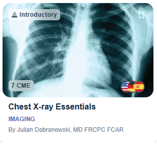 Chest X-ray Essentials